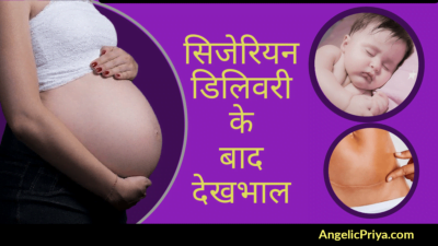 Cesarean Delivery Dekhbhal